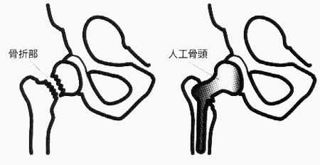 003-1.gif