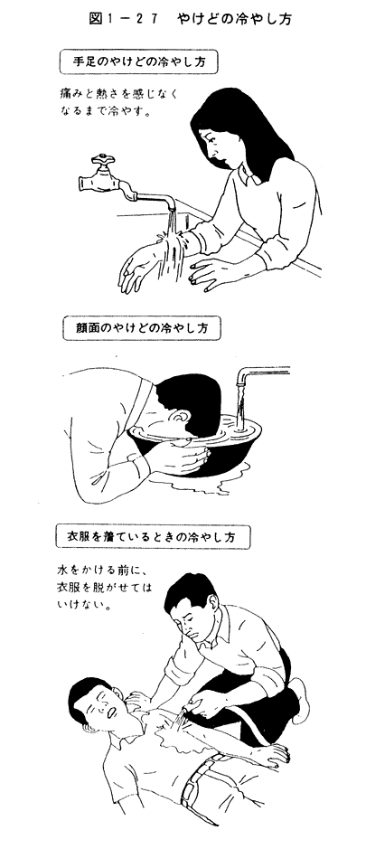 035-1.gif