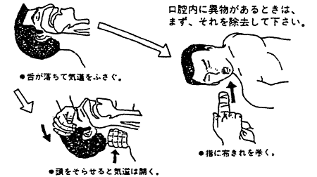 038-2.gif