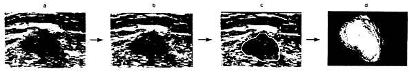 146-2.gif