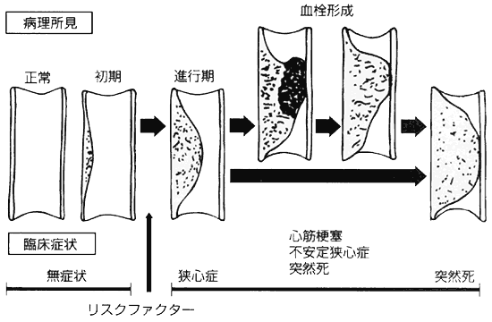 020-1.gif