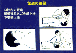 006-2.gif