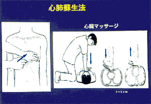 006-3.gif