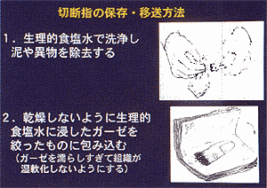 009-1.gif