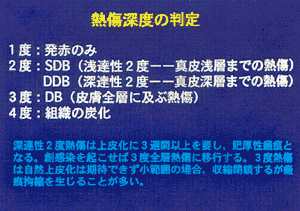 009-4.gif